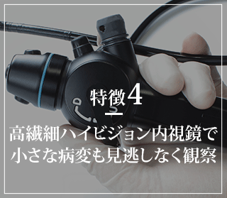 特徴4 高精細ハイビジョン内視鏡で小さな病変も見逃しなく観察